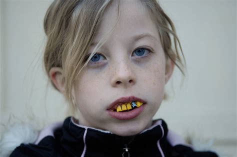are fake teeth bad